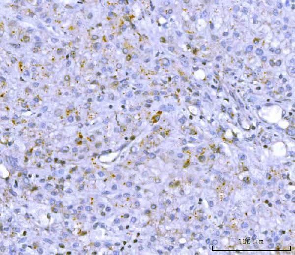 Anti-PCSK9 Antibody Picoband® Boster Bio