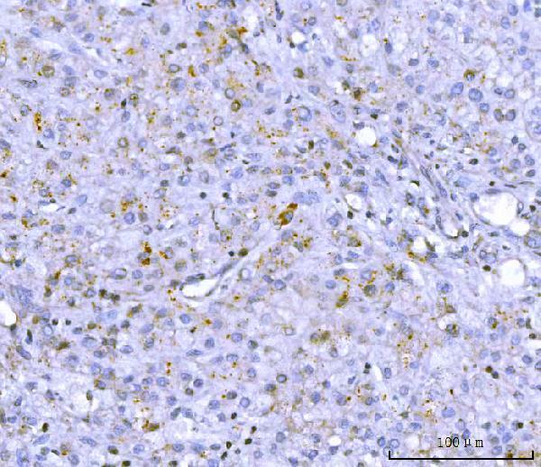 Anti-PCSK9 Antibody Picoband® Boster Bio