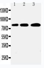 Anti-PLK2 Antibody Picoband® Boster Bio