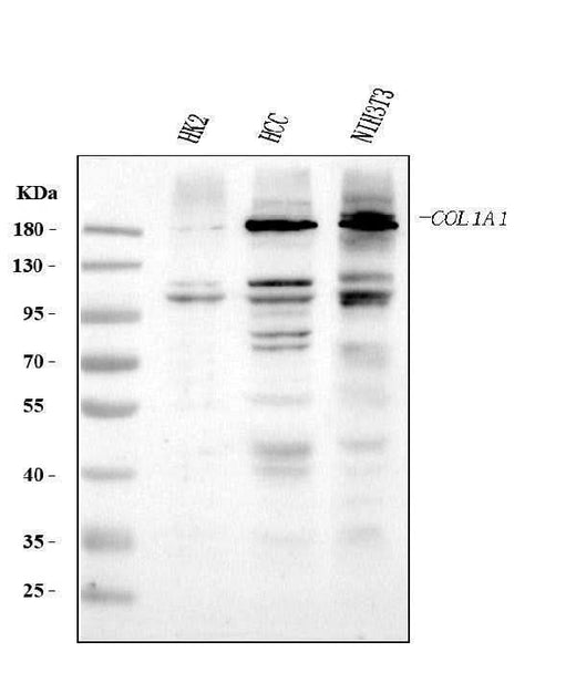 Anti-Collagen I/COL1A1 Antibody Picoband® Boster Bio