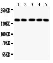 Anti-Collagen II/COL2A1 Antibody Picoband® Boster Bio