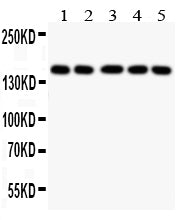 Anti-Collagen II/COL2A1 Antibody Picoband® Boster Bio