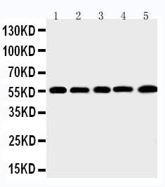 Anti-Macrophage metalloelastase MMP12 Antibody Picoband® Boster Bio