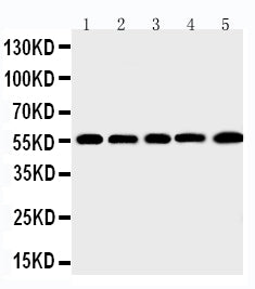 Anti-Macrophage metalloelastase MMP12 Antibody Picoband® Boster Bio