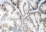 Anti-Matrix metalloproteinase-14 MMP14 Antibody Picoband® Boster Bio