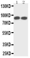 Anti-TrkA/NTRK1 Antibody Picoband® Boster Bio