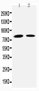 Anti-Transglutaminase 2/TGM2 Antibody Picoband® Boster Bio
