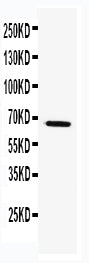 Anti-TRAF5 Antibody Picoband® Boster Bio