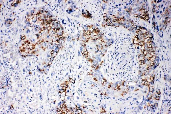 Anti-beta Arrestin 1/ARRB1 Antibody Picoband® Boster Bio
