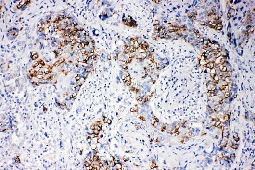Anti-beta Arrestin 1/ARRB1 Antibody Picoband® Boster Bio