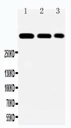 Anti-Laminin 2 alpha/LAMA2 Antibody Picoband® Boster Bio