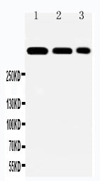 Anti-Laminin 2 alpha/LAMA2 Antibody Picoband® Boster Bio