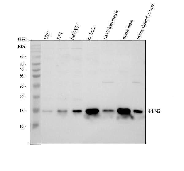Anti-Profilin 2/PFN2 Antibody Picoband® Boster Bio