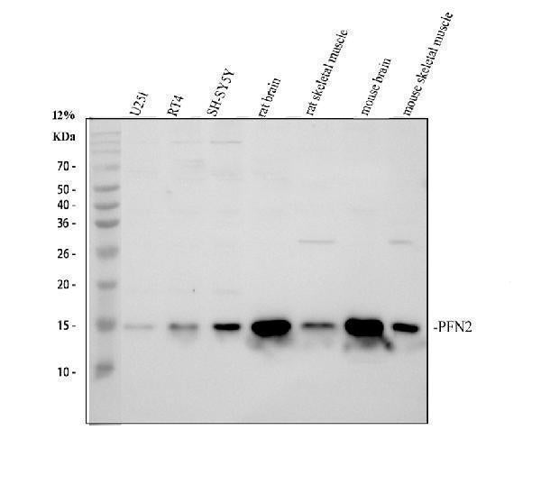 Anti-Profilin 2/PFN2 Antibody Picoband® Boster Bio
