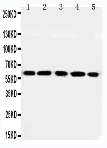 Anti-RGS14 Antibody Picoband® Boster Bio
