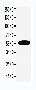 Anti-EAAT3/SLC1A1 Antibody Picoband® Boster Bio