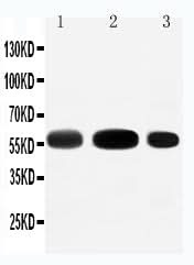 Anti-EAAT3/SLC1A1 Antibody Picoband® Boster Bio