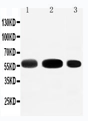 Anti-EAAT3/SLC1A1 Antibody Picoband® Boster Bio