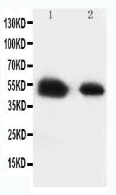 Anti-Glucose Transporter 8/SLC2A8 Antibody Picoband® Boster Bio