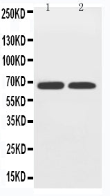 Anti-GLUT12/SLC2A12 Antibody Picoband® Boster Bio