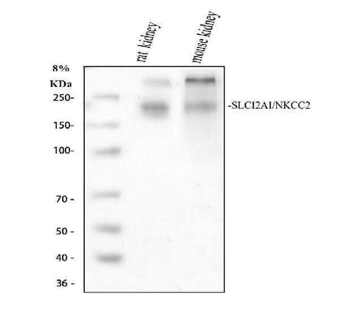Anti-SLC12A1 Antibody Picoband® Boster Bio
