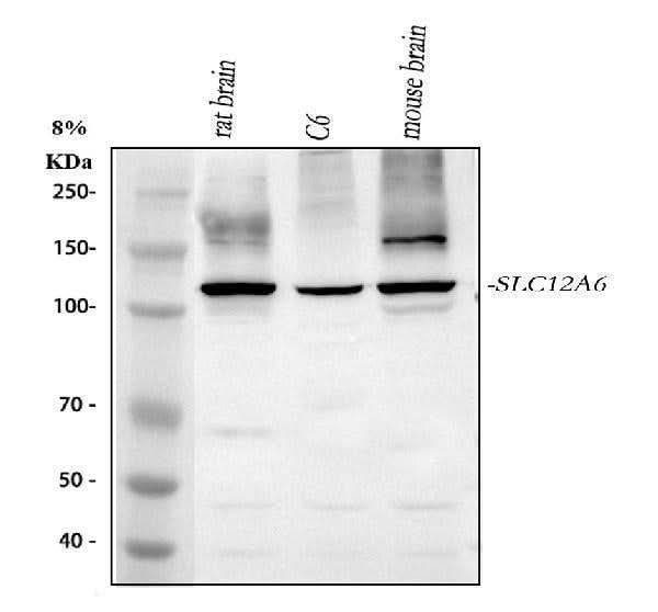 Anti-SLC12A6 Antibody Picoband® Boster Bio