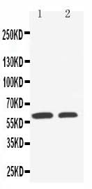 Anti-SLC22A1 Antibody Picoband® Boster Bio
