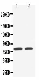 Anti-SLC22A1 Antibody Picoband® Boster Bio