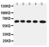 Anti-Solute carrier family 22 member 5/SLC22A5 Antibody Picoband® Boster Bio