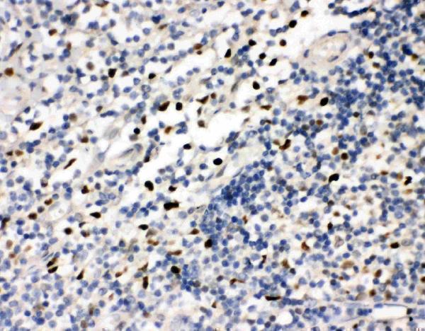 Anti-FLI1 Antibody Picoband® Boster Bio