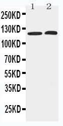 Anti-Histone deacetylase 5 HDAC5 Antibody Picoband® Boster Bio