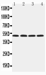Anti-Hyaluronidase-1 HYAL1 Antibody Picoband® Boster Bio