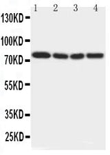 Anti-IRAK/IRAK1 Antibody Picoband® Boster Bio