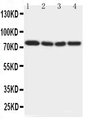 Anti-IRAK/IRAK1 Antibody Picoband® Boster Bio