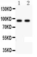 Anti-LI-Cadherin-17 CDH17-Antibody Picoband® Boster Bio