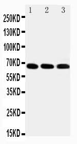 Anti-IRAKM/IRAK3 Antibody Picoband® Boster Bio