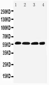 Anti-Interferon regulatory factor 5 IRF5 Antibody Picoband® Boster Bio