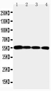 Anti-Matrix metalloproteinase-24 MMP24 Antibody Picoband® Boster Bio