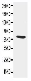 Anti-AACT/SERPINA3 Antibody Picoband® Boster Bio