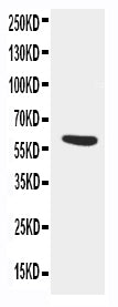 Anti-AACT/SERPINA3 Antibody Picoband® Boster Bio
