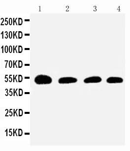Anti-Antithrombin III/SERPINC1 Antibody Picoband® Boster Bio