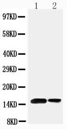 Anti-Sumo 1/SUMO1 Antibody Picoband® Boster Bio