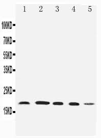 Anti-Diubiquitin/UBD Antibody Picoband® Boster Bio