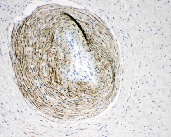 Anti-Calponin/CNN1 Antibody Picoband® Boster Bio