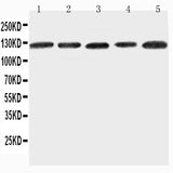 Anti-Integrin alpha-7 ITGA7 Antibody Picoband® Boster Bio
