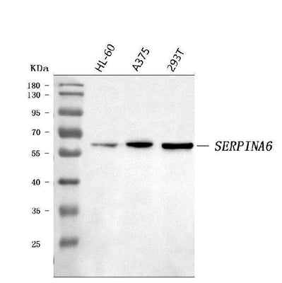 Anti-Cortisol Binding Globulin/SERPINA6 Antibody Picoband® Boster Bio