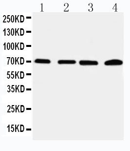 Anti-IRAK2 Antibody Picoband® Boster Bio