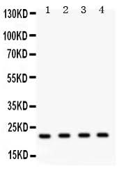 Anti-Securin/PTTG1 Antibody Picoband® Boster Bio