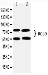 Anti-RGS9 Antibody Picoband® Boster Bio