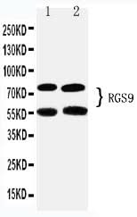Anti-RGS9 Antibody Picoband® Boster Bio